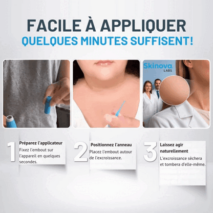Skinova Labs™ - Dites Adieu aux acrochordons