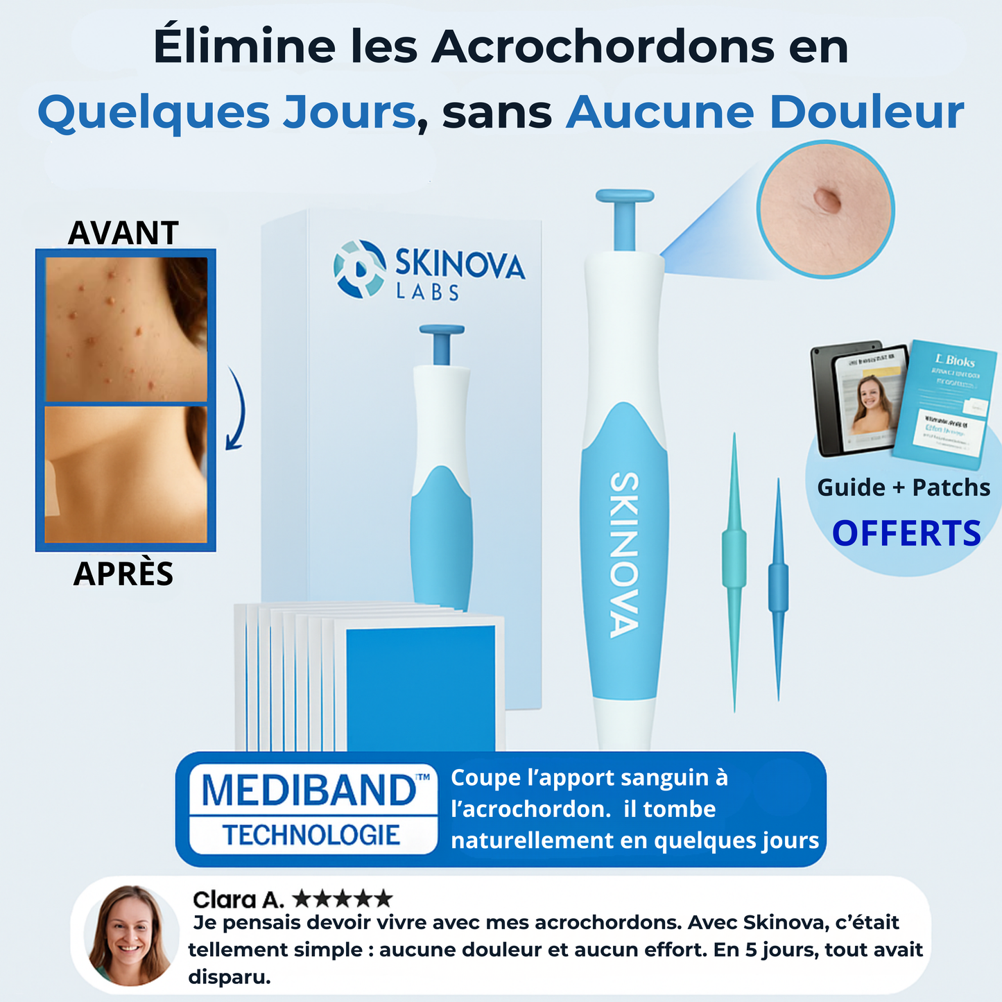 Skinova Labs™ - Dites Adieu aux acrochordons